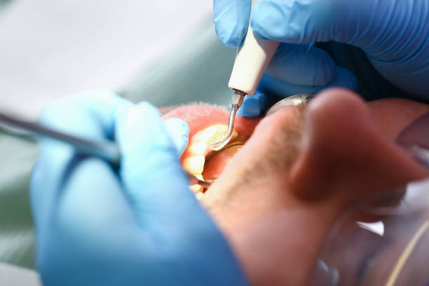 Best Walk-In Emergency Dental Services in Odessa, TX