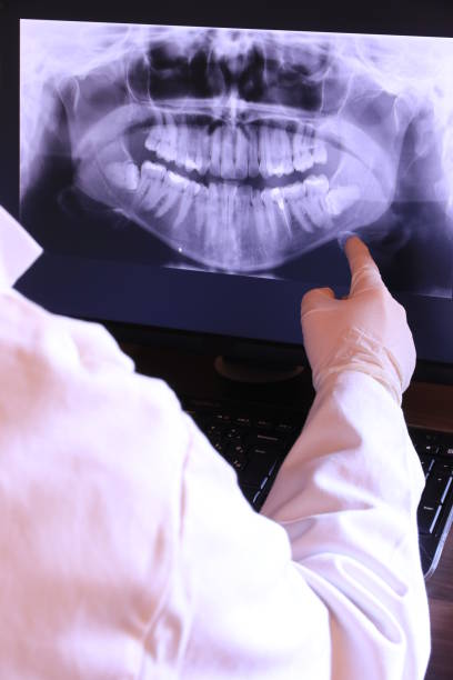 Best Emergency Wisdom Tooth Extraction in Odessa, TX